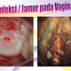 Illustration for article titled Obat Keputihan Alamiem/em